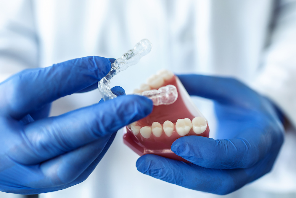 戴牙套推薦隱適美的原因有哪些？牙醫師真的推薦嗎？