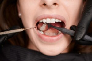 macro photography of a beautiful female smile with 2022 05 30 22 50 55 utc 1