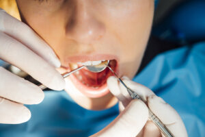 dentist examining a patient 2023 11 27 05 14 33 utc
