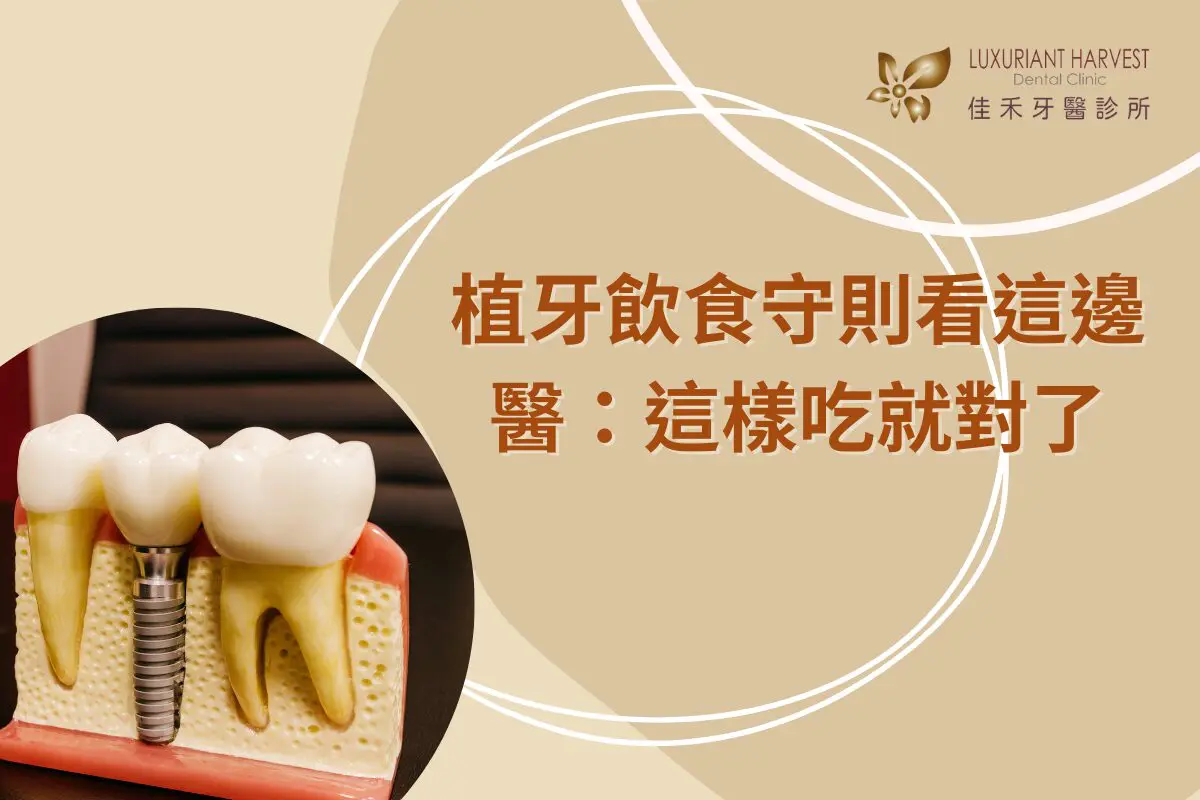 Read more about the article 植牙後飲食全指南：術後可以吃什麼？不能吃什麼？時間軸一次看