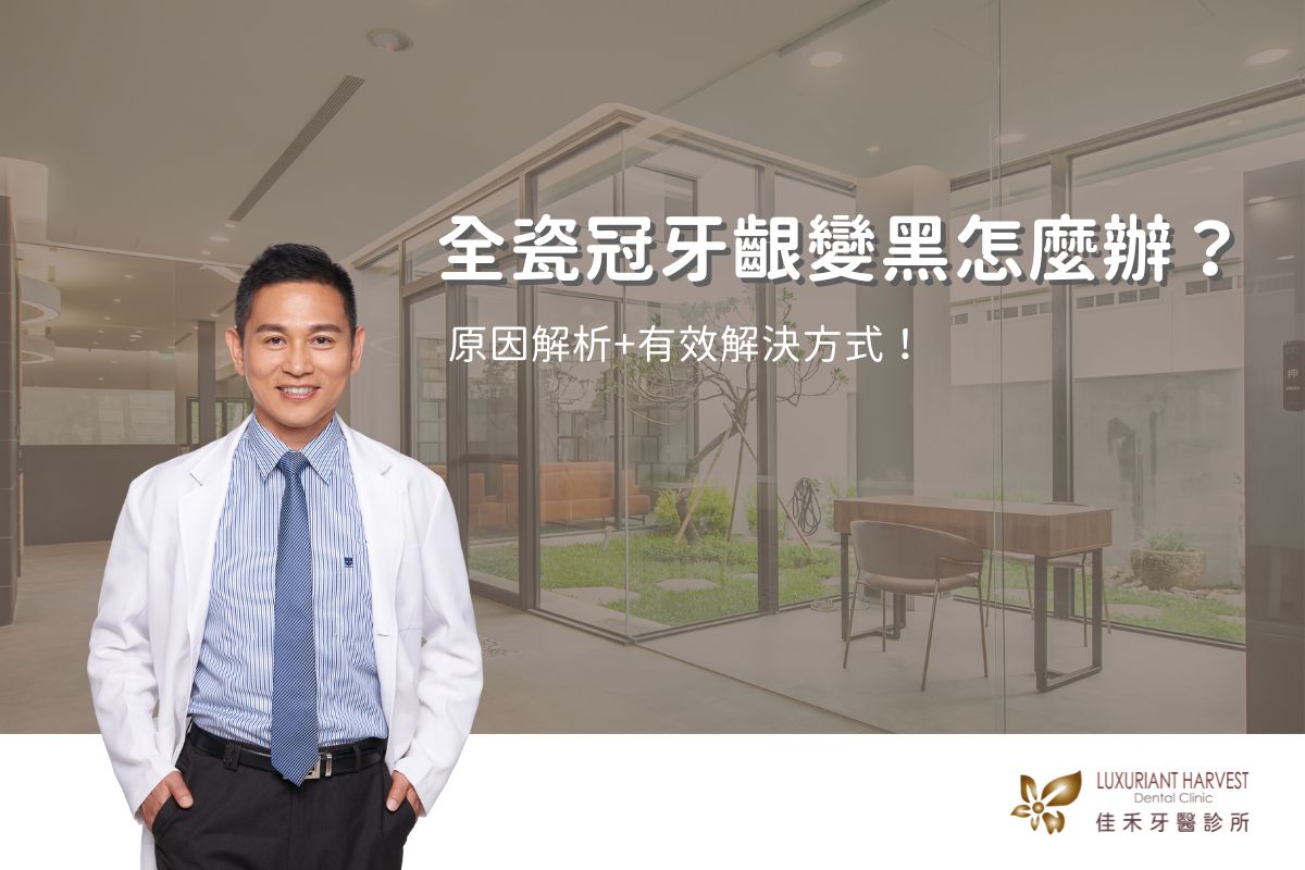 Read more about the article 全瓷冠牙齦變黑怎麼辦？原因解析+有效解決方式！
