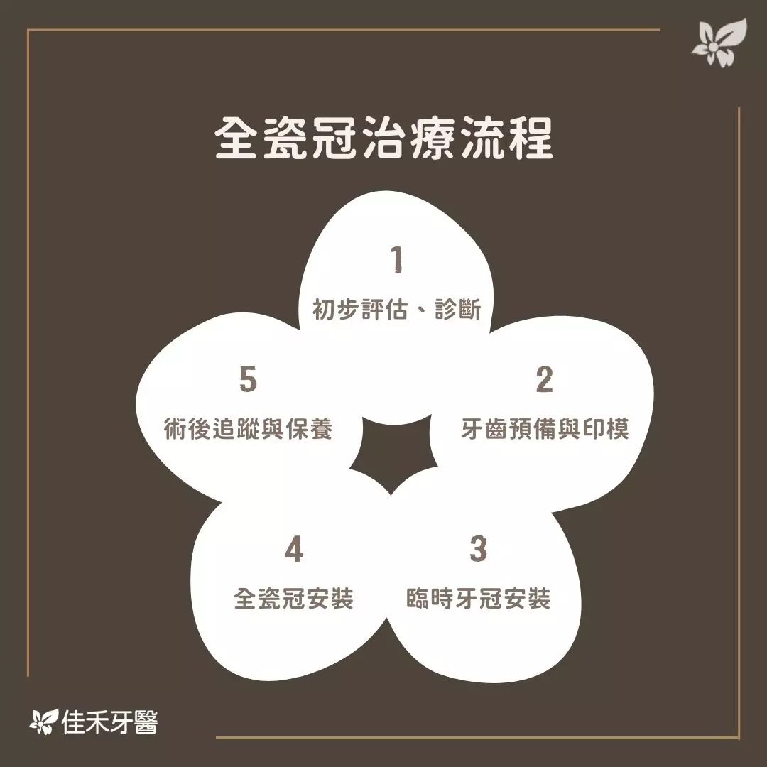 全瓷冠流程詳解:佳禾牙醫帶你了解治療全過程 1 全瓷冠治療流程