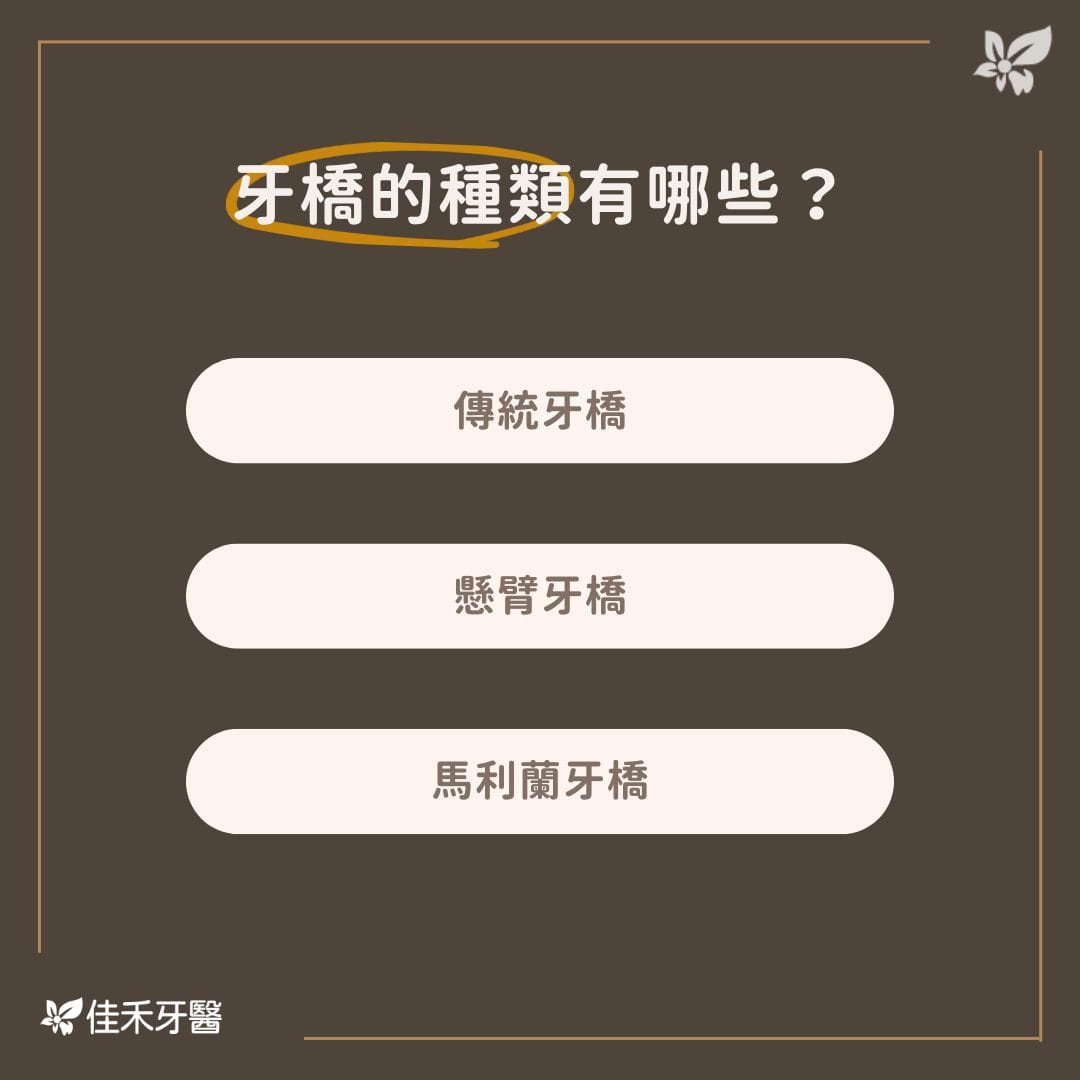 牙橋的種類有哪些？